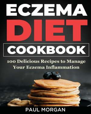 Eczema DIet Cookbook de Paul Morgan