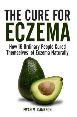 The Cure for Eczema de Ewan M. Cameron