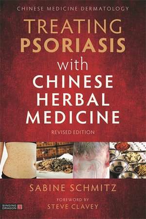 Treating Psoriasis with Chinese Herbal Medicine (Revised Edition) de Sabine Schmitz