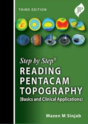 Step by Step: Reading Pentacam Topography: Basics and Clinical Applications de Mazen M. Sinjab