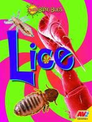 Lice de Pamela McDowell