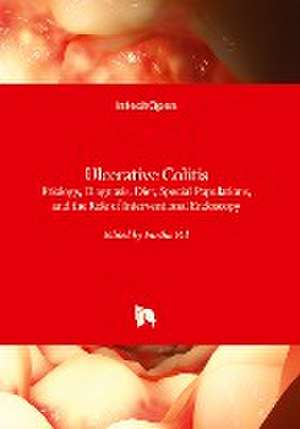 Ulcerative Colitis de Partha Pal