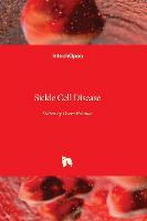 Sickle Cell Disease de Osaro Erhabor