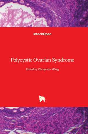 Polycystic Ovarian Syndrome de Zhengchao Wang