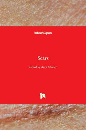 Scars de Anca Chiriac