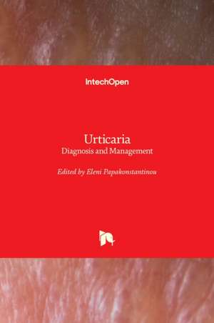 Urticaria de Eleni Papakonstantinou