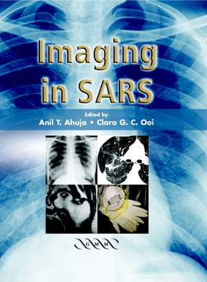 Imaging in SARS de A. T. Ahuja