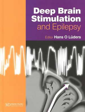 Deep Brain Stimulation and Epilepsy de Hans O. Lüders