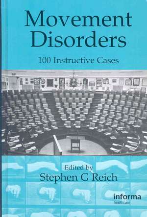 Movement Disorders: 100 Instructive Cases de Stephen G. Reich