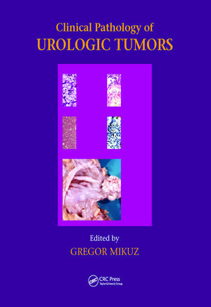 Clinical Pathology of Urological Tumours de Gregor Mikuz