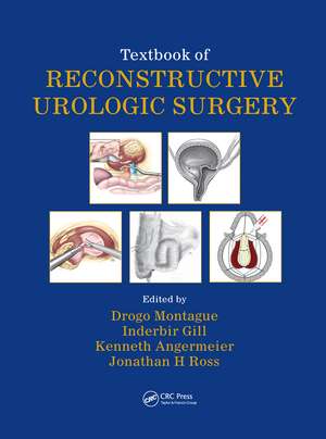 Textbook of Reconstructive Urologic Surgery de Drogo K. Montague