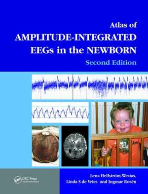 An Atlas of Amplitude-Integrated EEGs in the Newborn de Lena Hellström-Westas