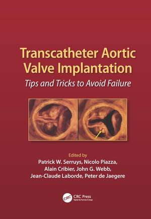 Transcatheter Aortic Valve Implantation: Tips and Tricks to Avoid Failure de Patrick W. Serruys