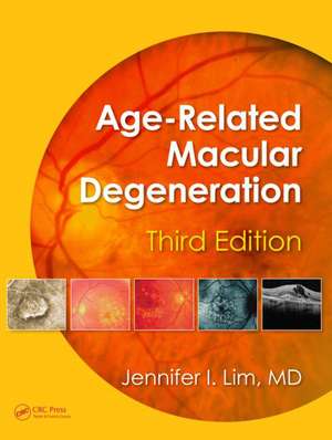 Age-Related Macular Degeneration, Third Edition de Jennifer I. Lim