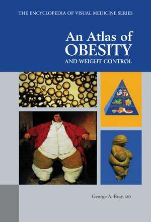 An Atlas of Obesity and Weight Control de George A. Bray