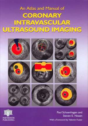 An Atlas and Manual of Coronary Intravascular Ultrasound Imaging de Paul Schoenhagen