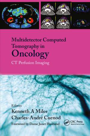 Multi-Detector Computed Tomography in Oncology: CT Perfusion Imaging de Kenneth Miles