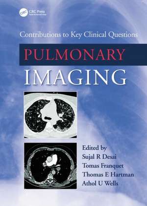 Pulmonary Imaging: Contributions to Key Clinical Questions de Sujal Desai