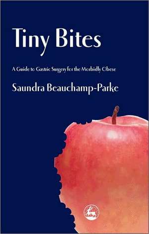 Tiny Bites: A Guide to Gastric Surgery for the Morbidly Obese de Saundra Beauchamp-Parke