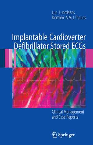 Implantable Cardioverter Defibrillator Stored ECGs: Clinical Management and Case Reports de Luc J. Jordaens