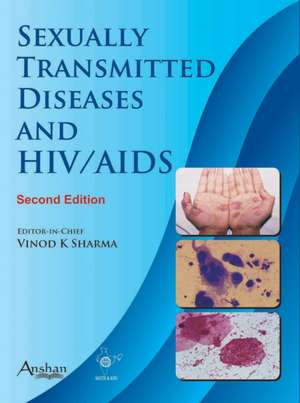 Sexually Transmitted Diseases and HIV & AIDS 2e de Vinod K. Sharma