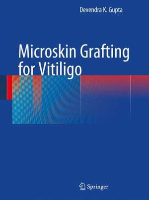 Microskin Grafting for Vitiligo de Devendra K. Gupta