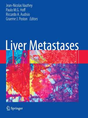 Liver Metastases de Jean-Nicolas` Vauthey