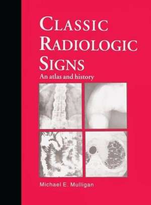 Classic Radiologic Signs de M. E. Mulligan