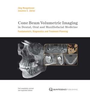 Cone Beam Volumetric Imaging in Dental, Oral and Maxillofacial Medicine: Fundamentals, Diagnostics and Treatment Planning de Jörg Neugebauer