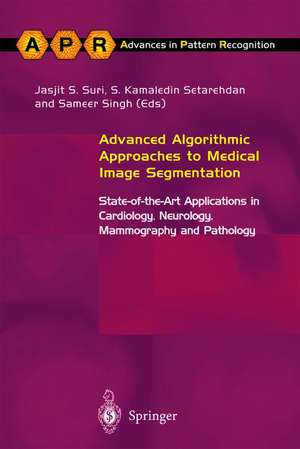 Advanced Algorithmic Approaches to Medical Image Segmentation: State-of-the-Art Applications in Cardiology, Neurology, Mammography and Pathology de S. Kamaledin Setarehdan