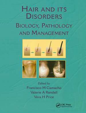 Hair and Its Disorders: Biology, Pathology and Management de Francisco M. Camacho