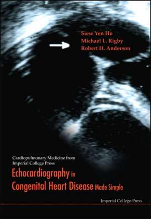 Echocardiography in Congenital Heart Dis: Getting Maximum Yield from Surface Min de M L RIGBY "A N REDINGTON