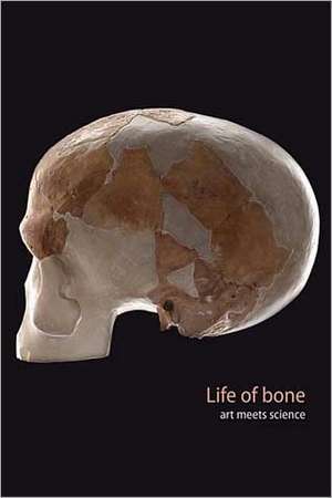 Life of Bone de Joni Brenner