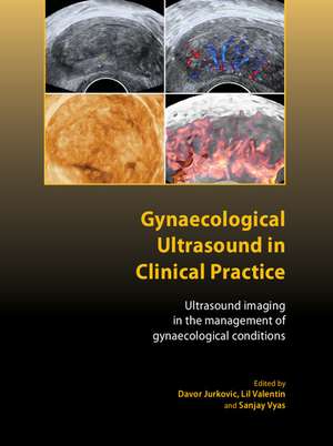 Gynaecological Ultrasound in Clinical Practice: Ultrasound Imaging in the Management of Gynaecological Conditions de Davor Jurkovic