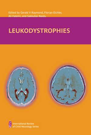 Leukodystrophies de S Naidu