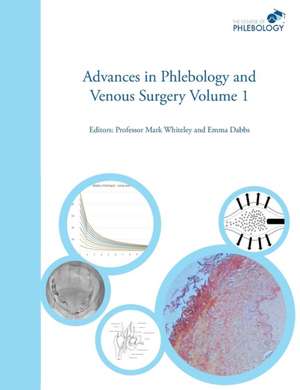 Advances in Phlebology and Venous Surgery Volume 1 de Emma B Dabbs