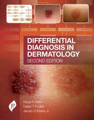 Differential Diagnosis in Dermatology: Second Edition de Klaus F Helm