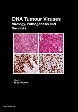 DNA Tumour Viruses de Sally Roberts