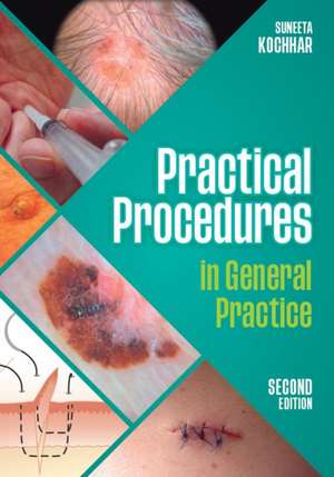 Practical Procedures in General Practice, second edition de Suneeta (GP in East Sussex) Kochhar