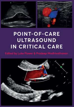 Point-of-Care Ultrasound in Critical Care de Luke Flower