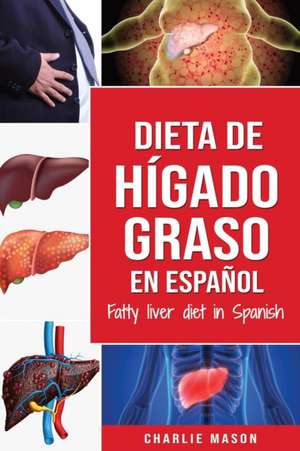 Dieta de hígado graso en español/Fatty liver diet in Spanish de Charlie Mason