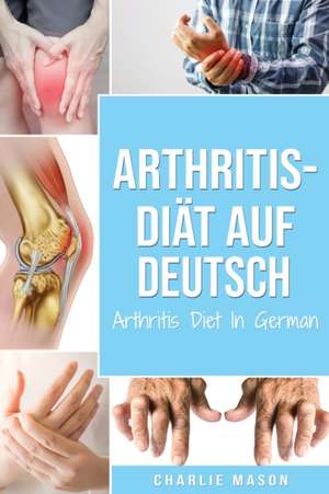 Arthritis-Diät Auf Deutsch/ Arthritis Diet In German (German Edition) de Charlie Mason