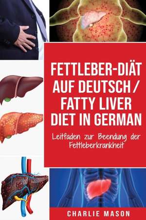 Fettleber-Diät Auf Deutsch/ Fatty liver diet In German de Charlie Mason