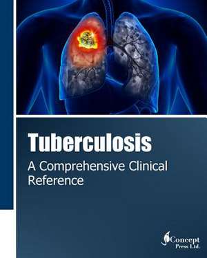 Tuberculosis