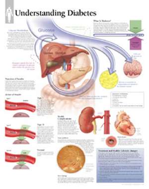 Understanding Diabetes Chart: Laminated Wall Chart de Scientific Publishing