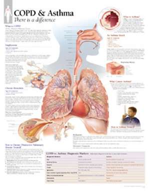 Copd/Asthma Chart: Wall Chart de Scientific Publishing