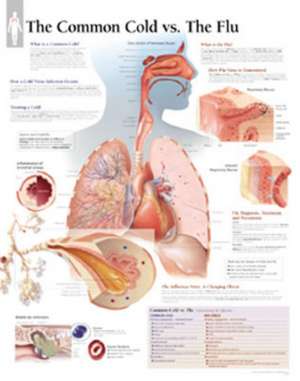 Common Cold vs the Flu Laminated Poster de Scientific Publishing