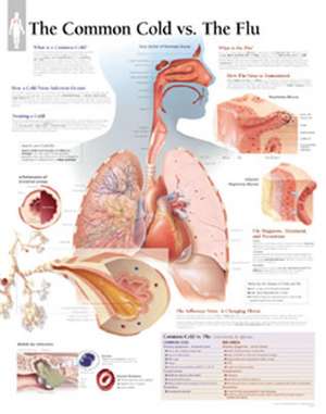 The Common Cold Vs Flu Chart: Laminated Wall Chart de Scientific Publishing