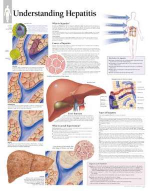 Understanding Hepatitis Chart: Wall Chart de various