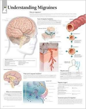 Understanding Migraines Paper Poster de Scientific Publishing